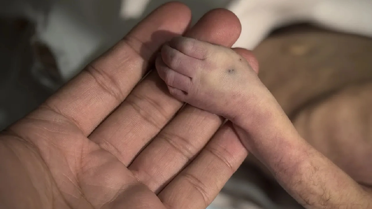 Cold Kills Another Palestinian Baby in Gaza