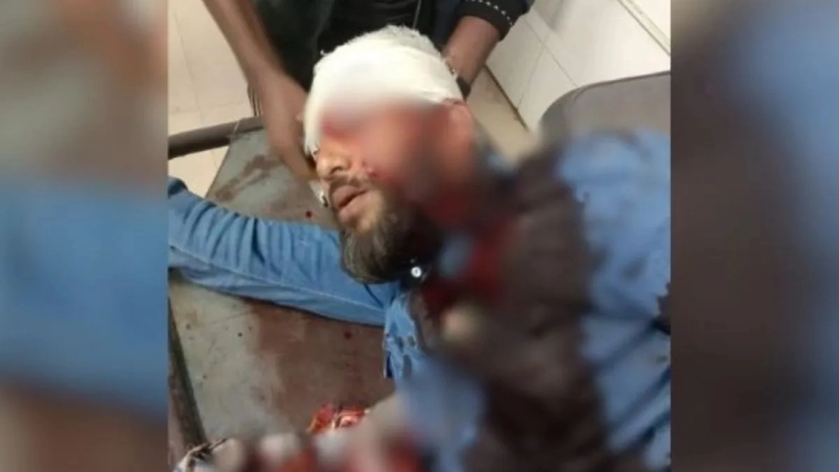 NCP Khulna divisional head shot in the head